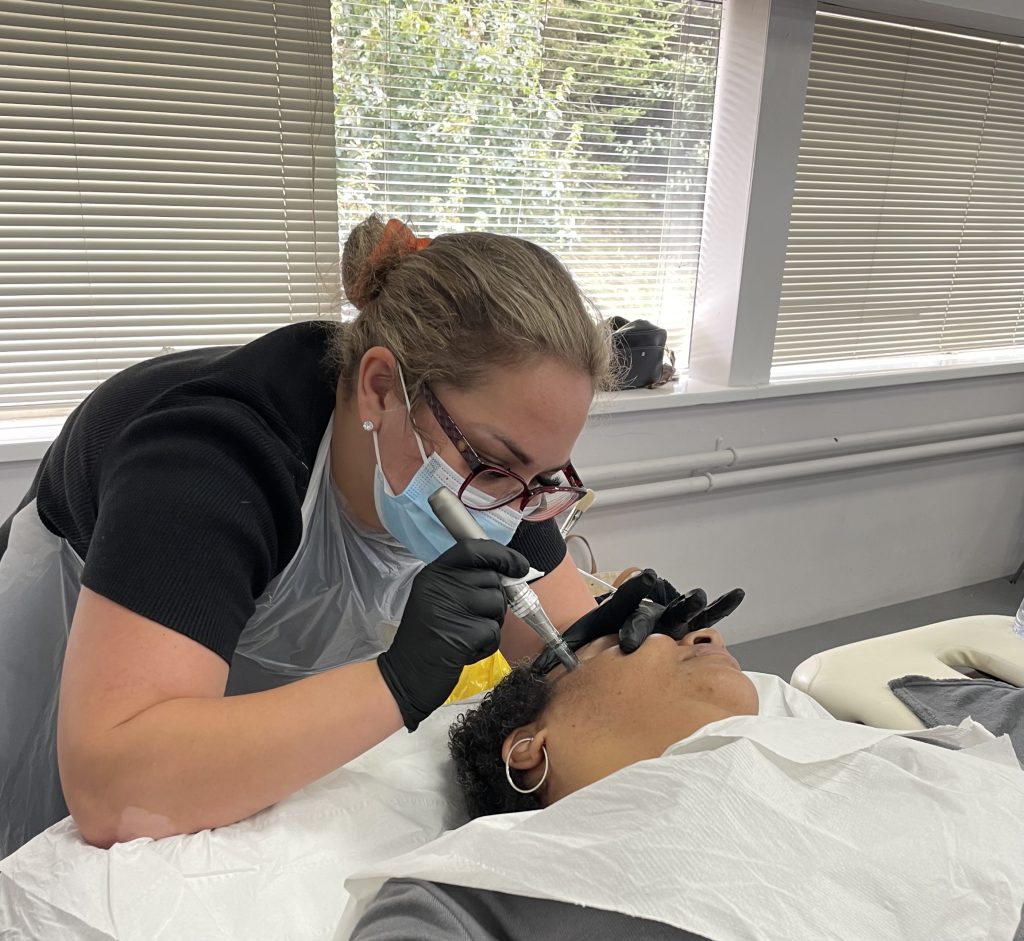 mircroneedling-picture-1