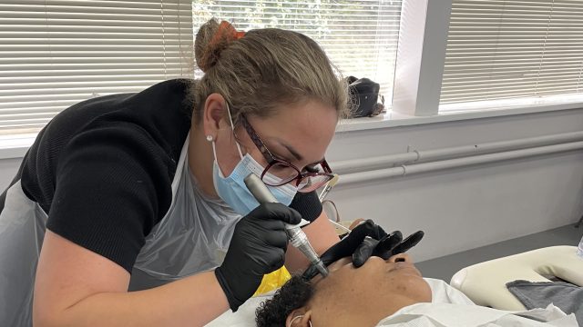 mircroneedling-picture-1