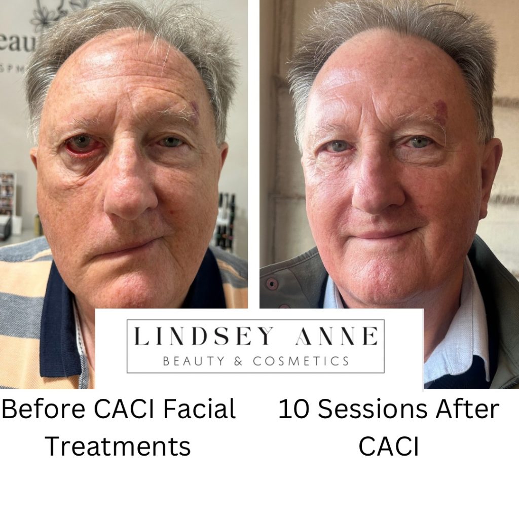 20250122_203707281_iOS