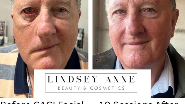 20250122_203707281_iOS